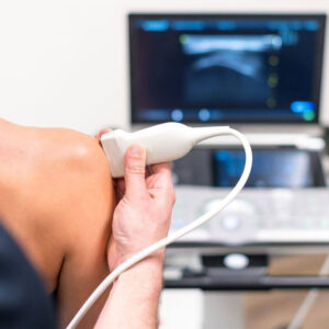 De meerwaarde van echografie in de fysiotherapiepraktijk 2 echo schouder