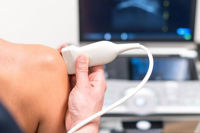 De meerwaarde van echografie in de fysiotherapiepraktijk 1 echo schouder